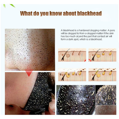 Black Head Remover Mask Black Face